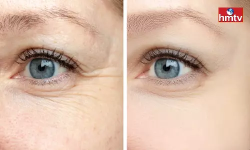 Add These Foods to Your Diet to get rid of Wrinkles Under the Eyes
