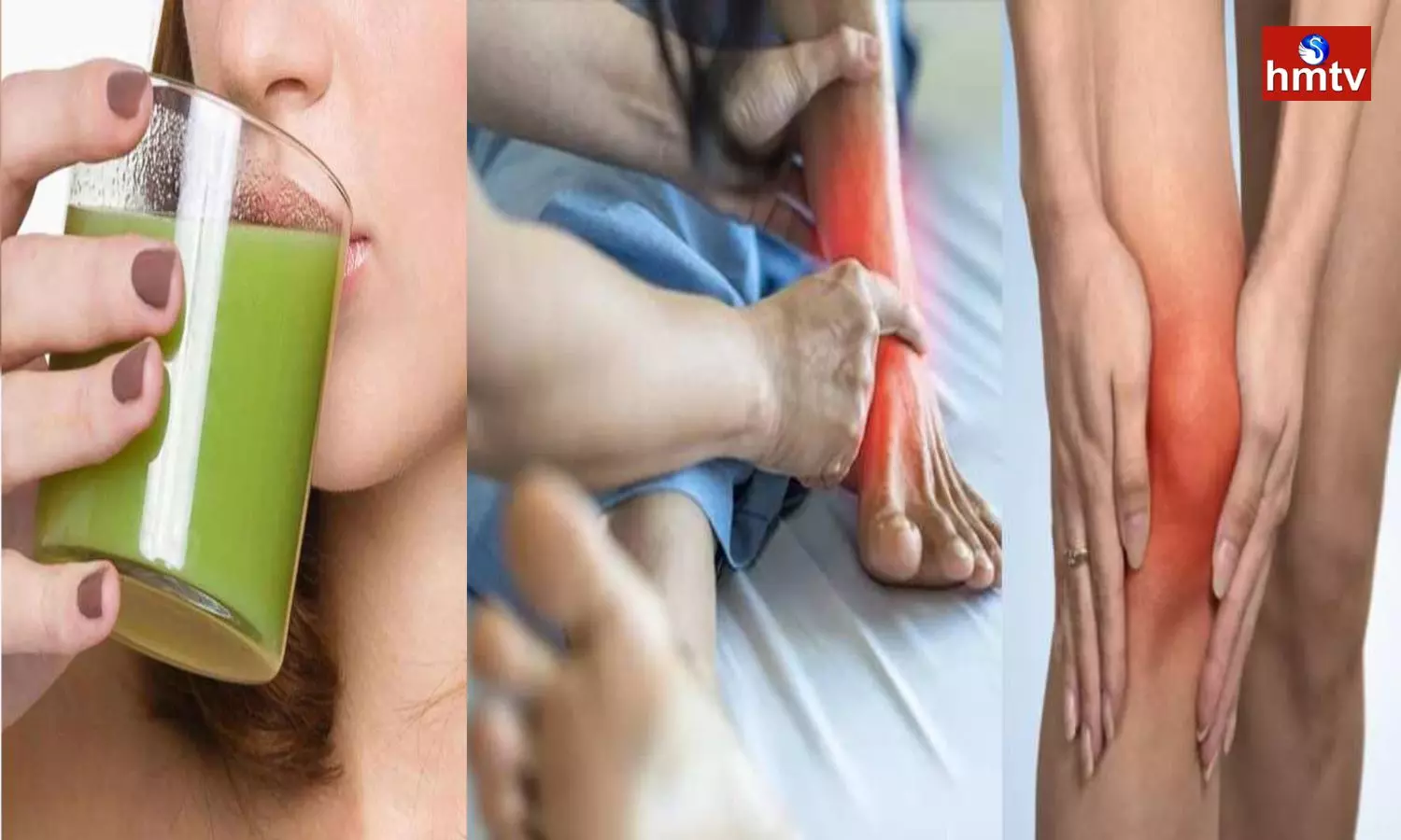 Arthritis due to Uric Acid Drinking Bottle Gourd Juice Relieves it