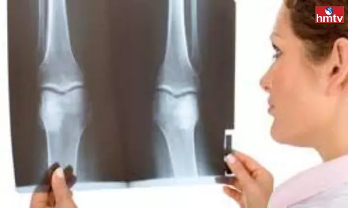 These Bad Habits Make the Bones Weak