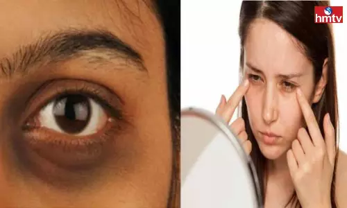 What are the Causes of Dark Circle Problem Why Medicines do not Work What are the Causes of Dark Circle Problem Why Medicines do not Work