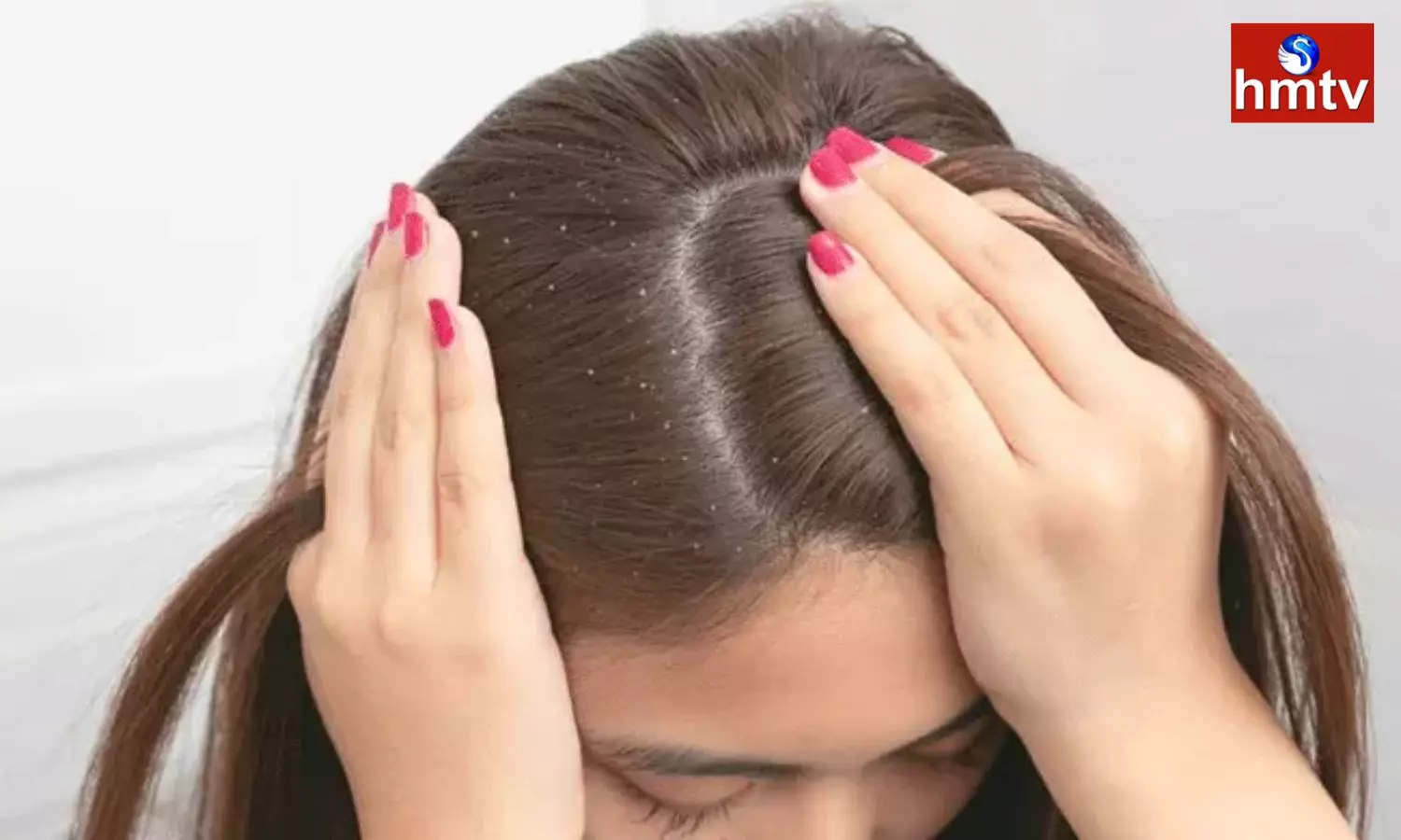 Are you troubled by dandruff it will be completely removed by these natural methods