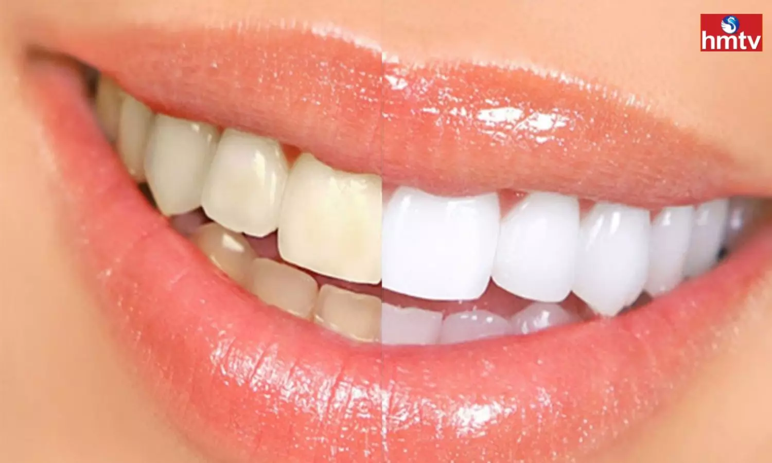 Health Tips: The yellow color of the teeth will disappear quickly follow these tips at home