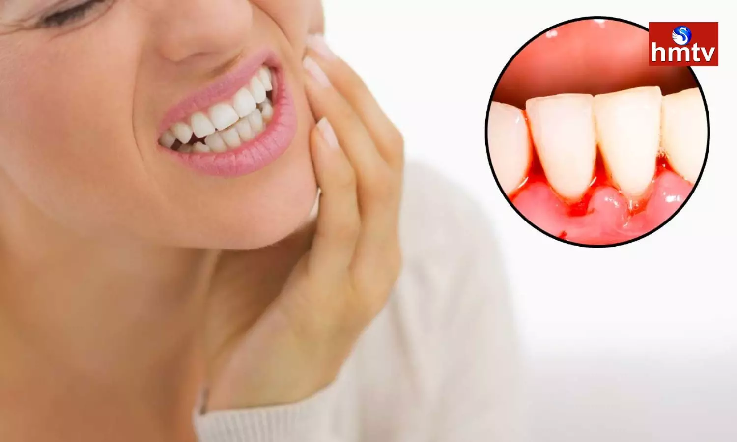 Bleeding gums follow these home remedies to get immediate relief