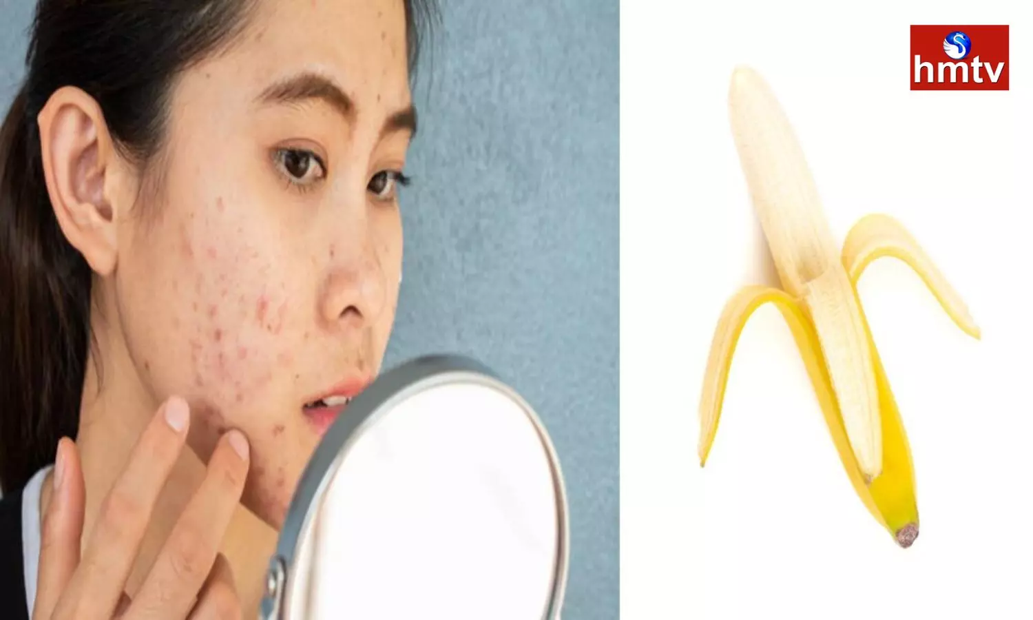 Check for Pimples on the Face With a Banana