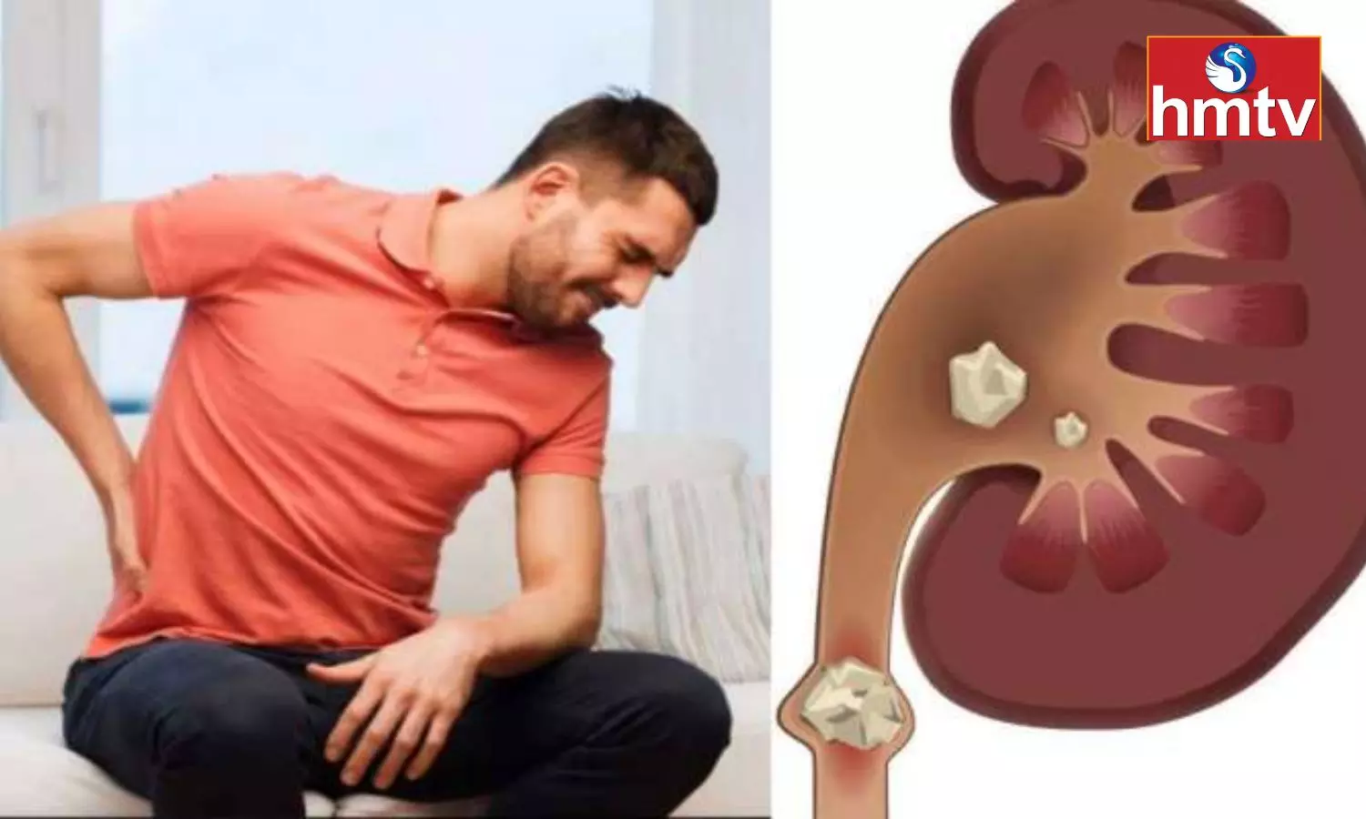 If There are Stones in the Kidney These Symptoms Will Appear