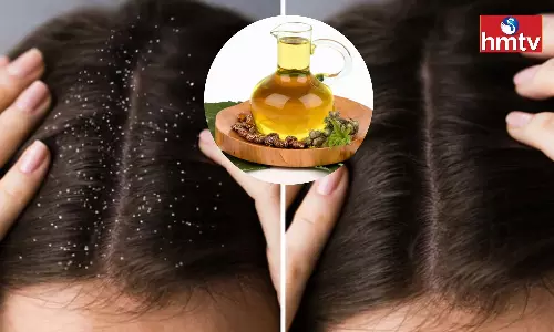 Castor Oil Removes Dandruff Makes Hair Beautiful