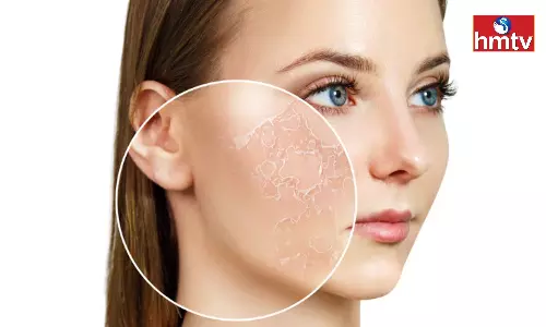 Raw Milk Removes Dry Skin Easily use it Like This