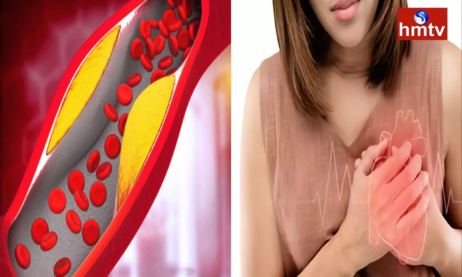 Risk of High Cholesterol at a Young Age do not Ignore These Symptoms