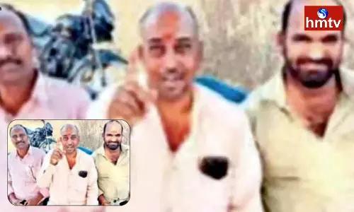 Bald Head Victims Association Demanding Telangana Government To Provide RS 6000 Pension