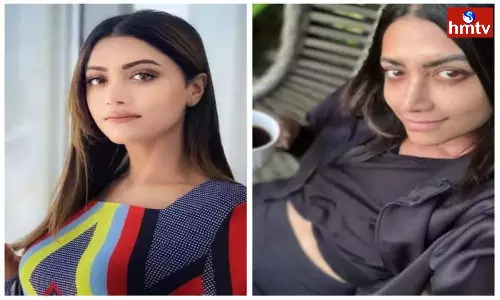 Actress Mamta Mohandas is Suffering from Skin Disease Actress Mamta Mohandas is Suffering from Skin Disease