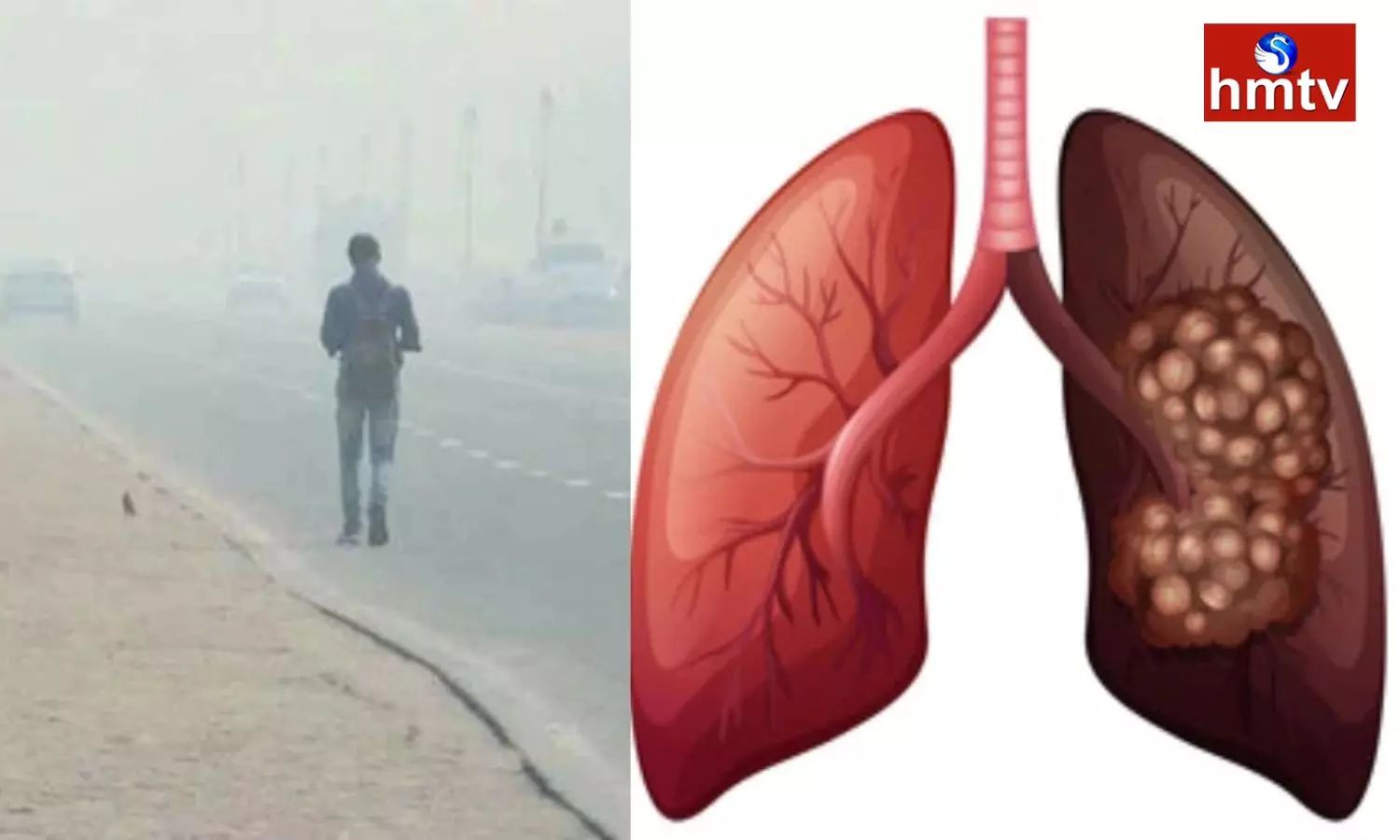 Effect of Winter Fog on Lungs Take These Precautions