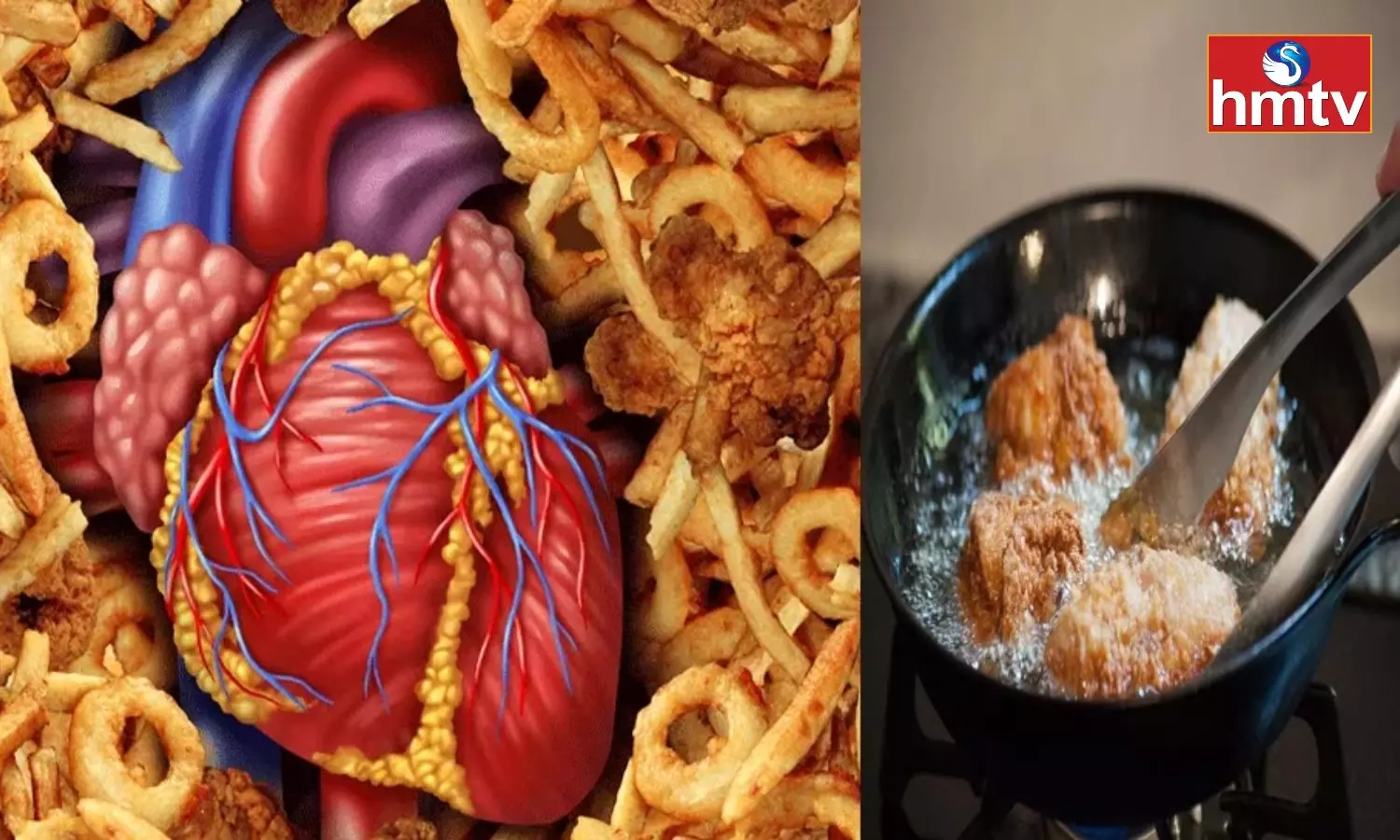 WHO Warns Trans-fat Foods is the Cause of 5 Billion Heart Attacks