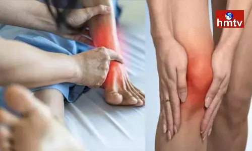 If Uric Acid Increases These Problems Will Occur get rid of it Like This If Uric Acid Increases These Problems Will Occur get rid of it Like This