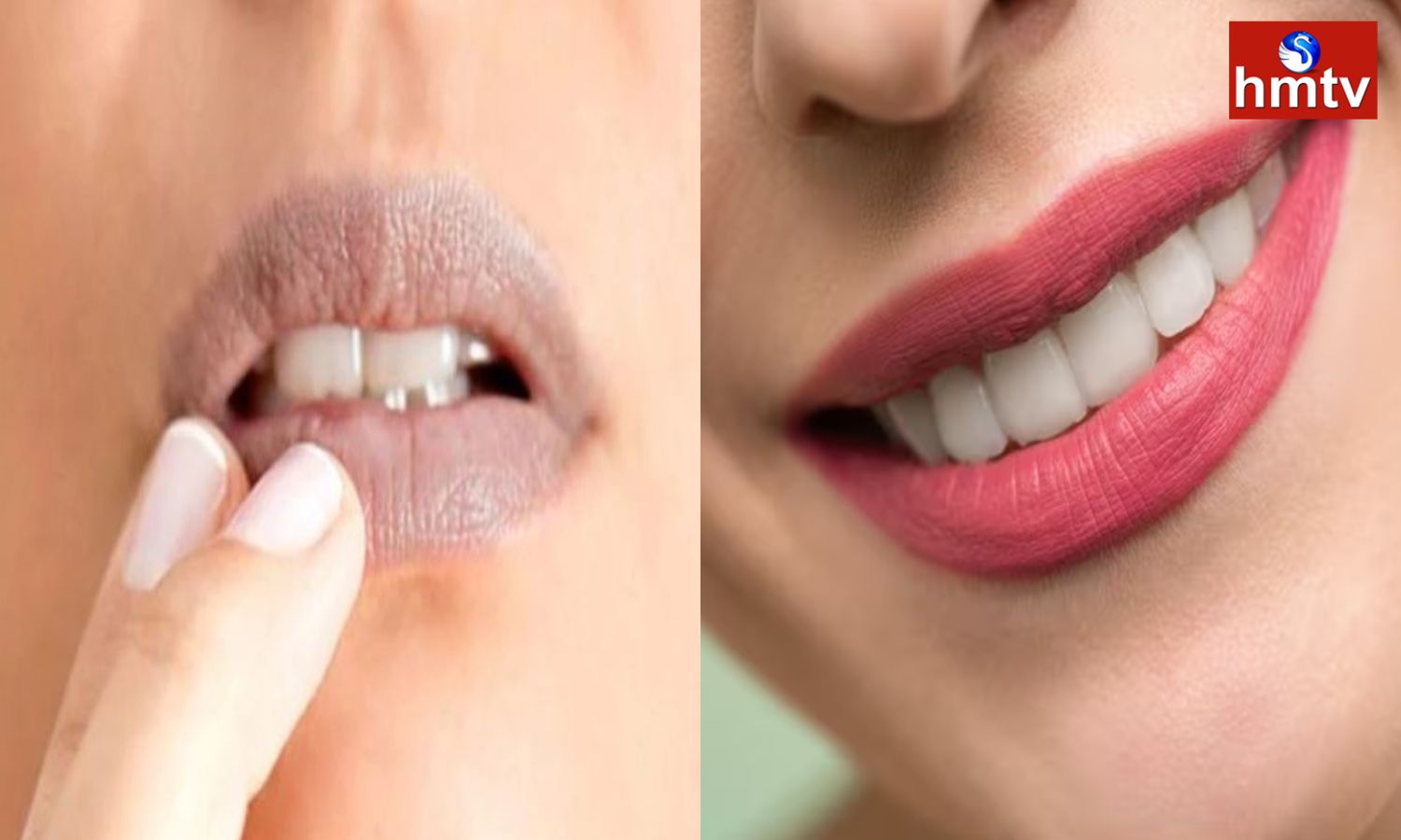 Lip Care Tips పెదవులు నల్లగా మారాయా.. ఈ చిట్కా ఉపయోగించి ఎర్రగా