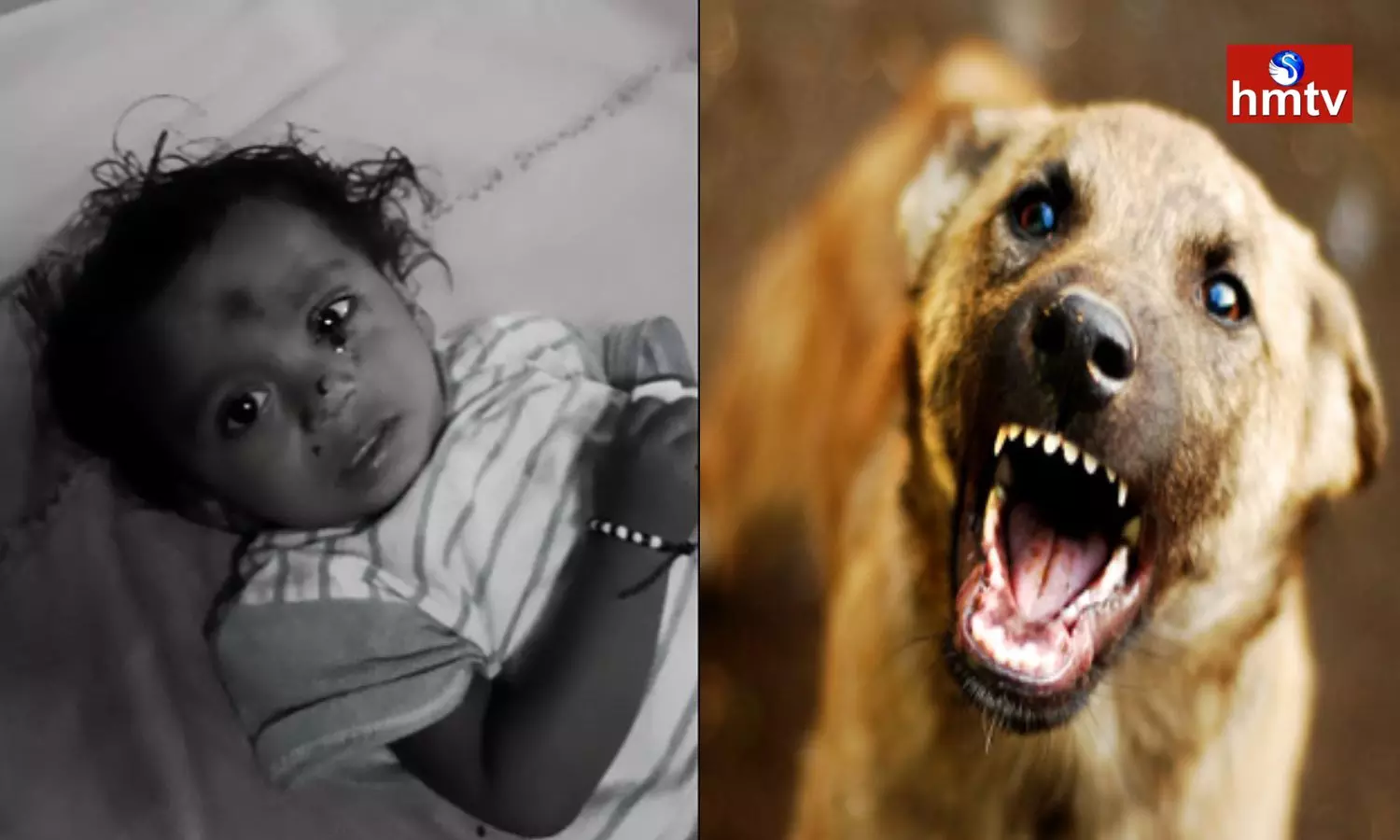 Stray Dogs Attack A Child In Khammam