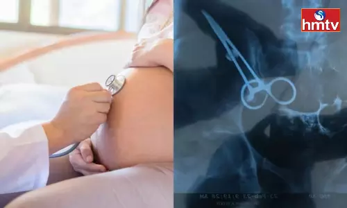Scissor Left in Woman’s Stomach in Peddapally