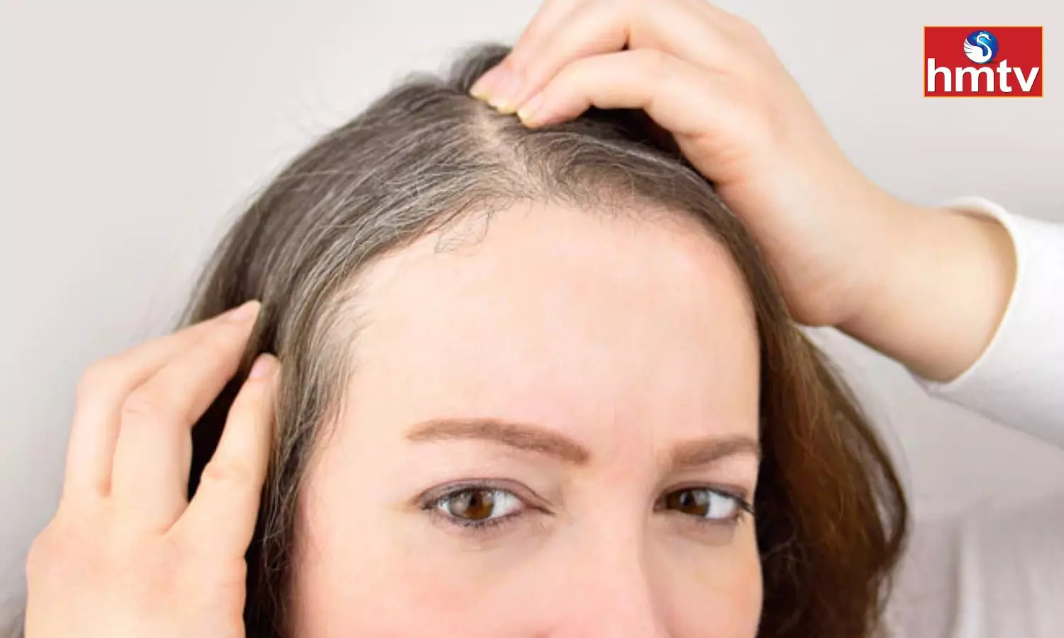 These are the Causes of Gray Hair at a Young Age Know How to Prevent Them