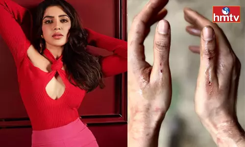 Samantha Injuried in Citadel Web Series Shooting