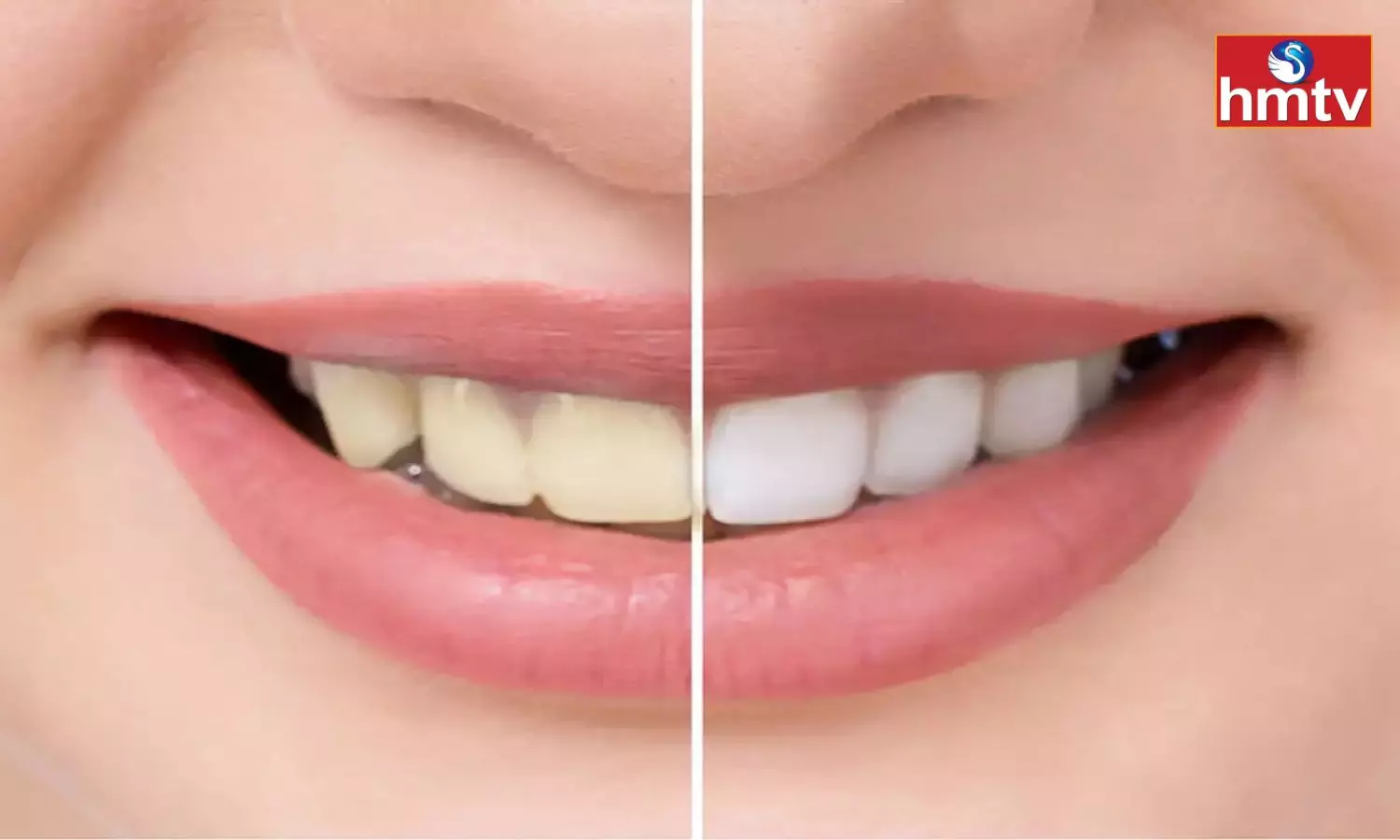Have Yellow Teeth Whiten Them With These Tips
