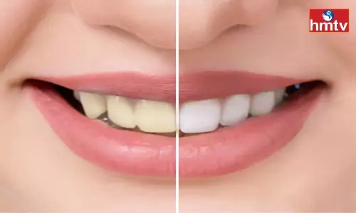 Have Yellow Teeth Whiten Them With These Tips