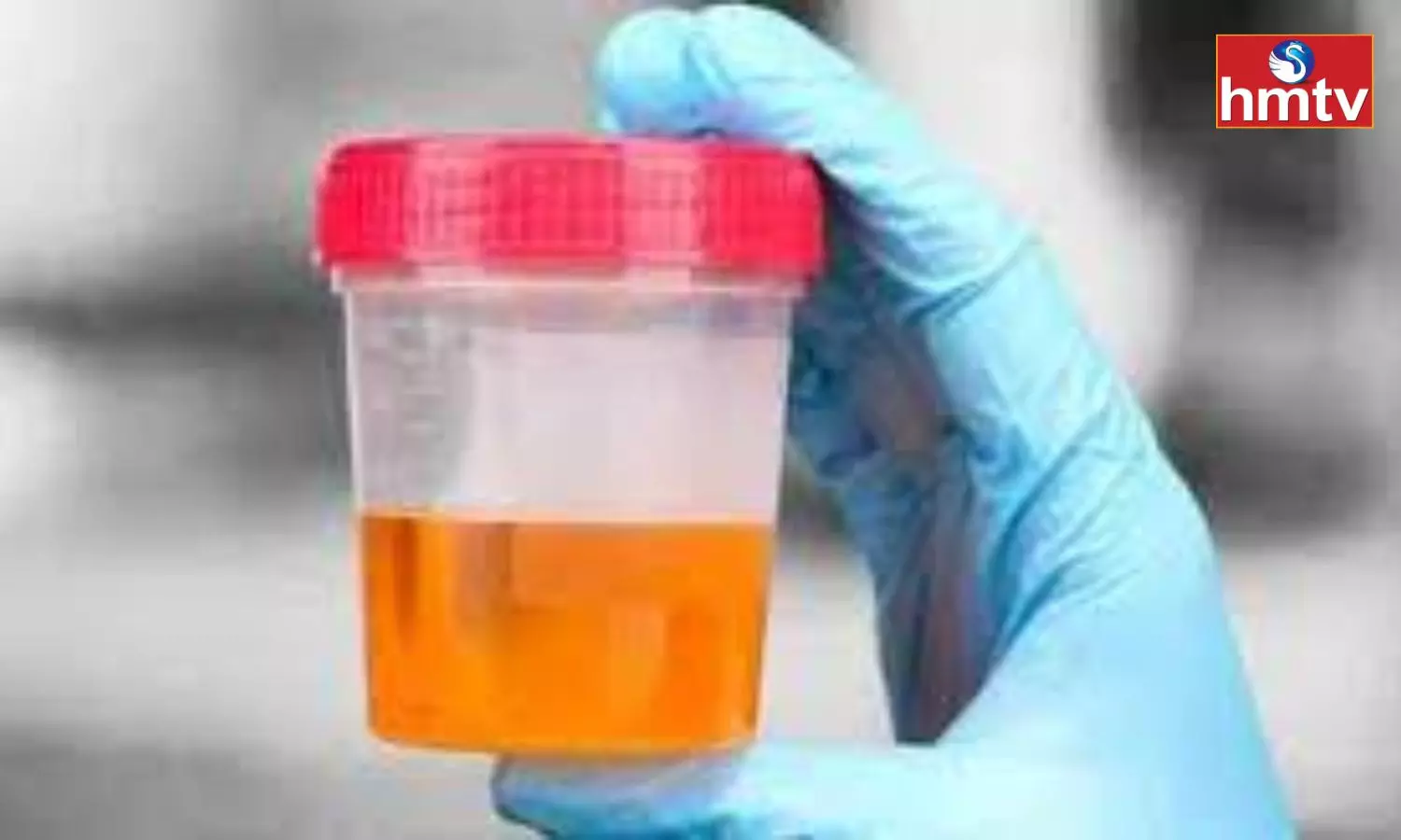 Urine Color Suddenly Turned Orange Very Dangerous Know About These Reasons