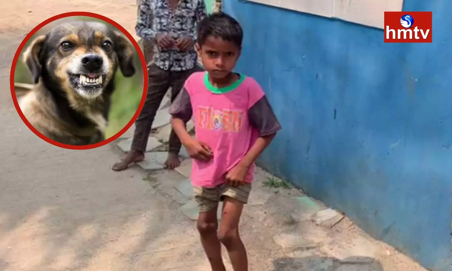Stray Dogs Attacked Boy In Nacharam Hyderabad