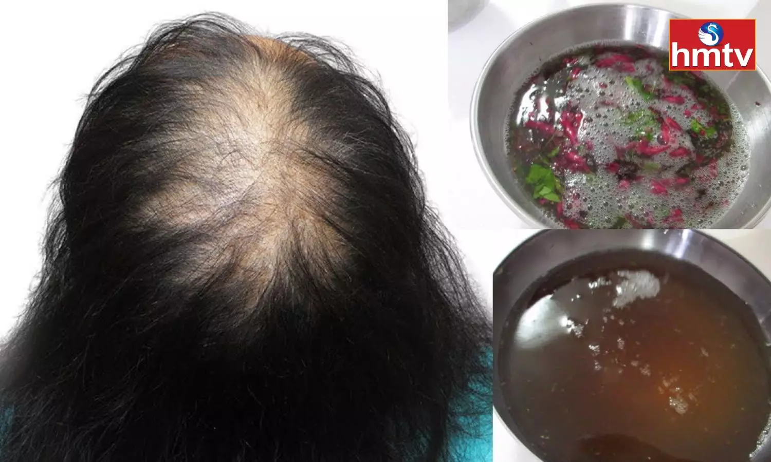 Hibiscus Oil and Almond Oil Combination Stops Hair Fall