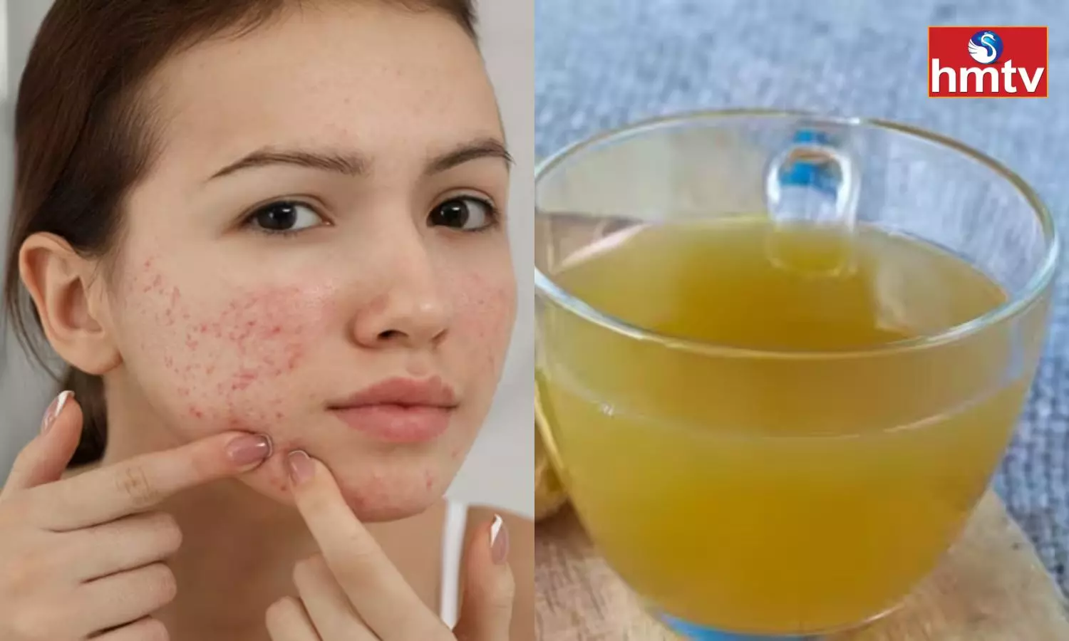 Do you have Acne Problem Check This Magic Drink