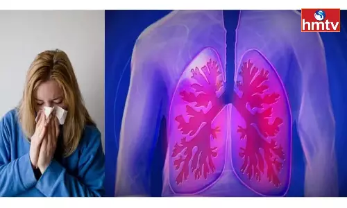 H3N2 Virus Linked to Spike in Cough, Fever Cases in Country