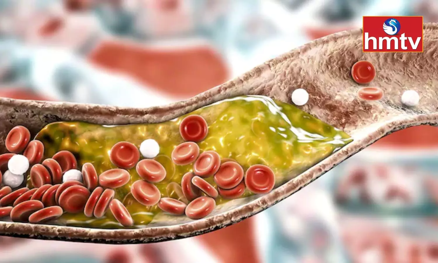 Cholesterol is a Silent Killer Make These Changes in Your Diet Immediately