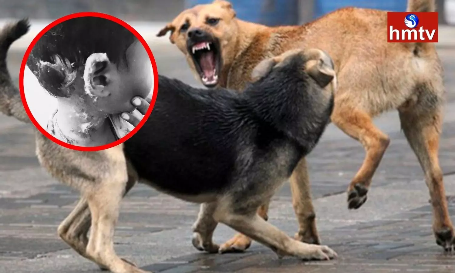 Dogs Attack Boy In Badangpet