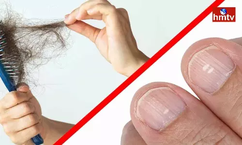 Symptoms of Vitamin Deficiency If Diet is not Changed it is Very Dangerous