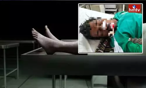 Dead Man Taken to Mortuary, Doctors Surprised After he Awakes Dead Man Taken to Mortuary, Doctors Surprised After he Awakes