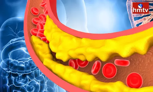 Olive Oil Good for Healthy Heart Check Health Benefits of Olive Oil Olive Oil Good for Healthy Heart Check Health Benefits of Olive Oil