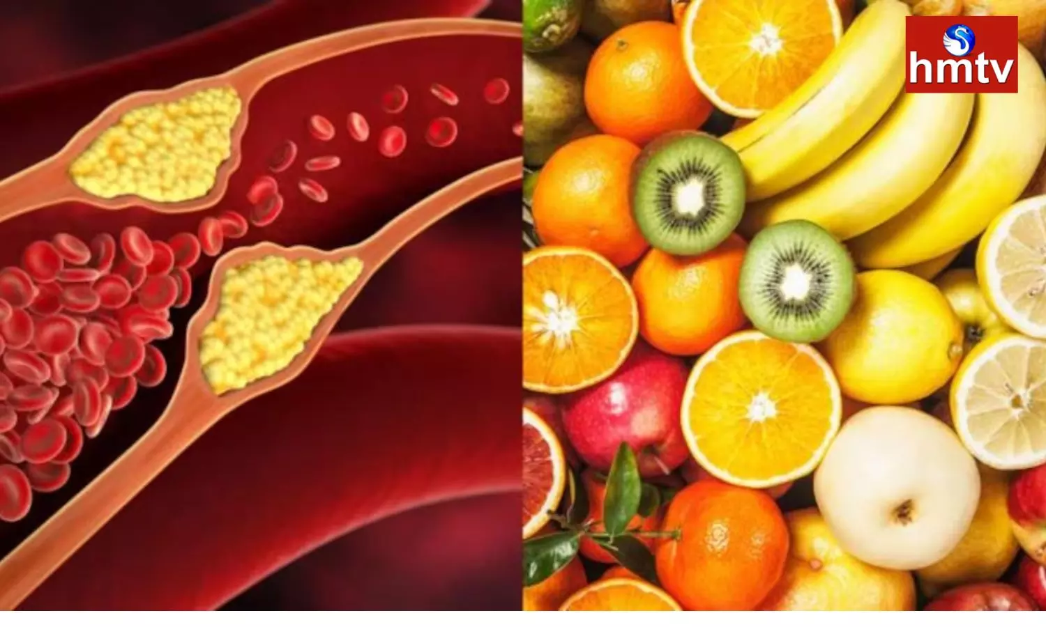 Include These 6 Super Fruits in Your Diet to Control Bad Cholesterol Check Amazing Health Benefits