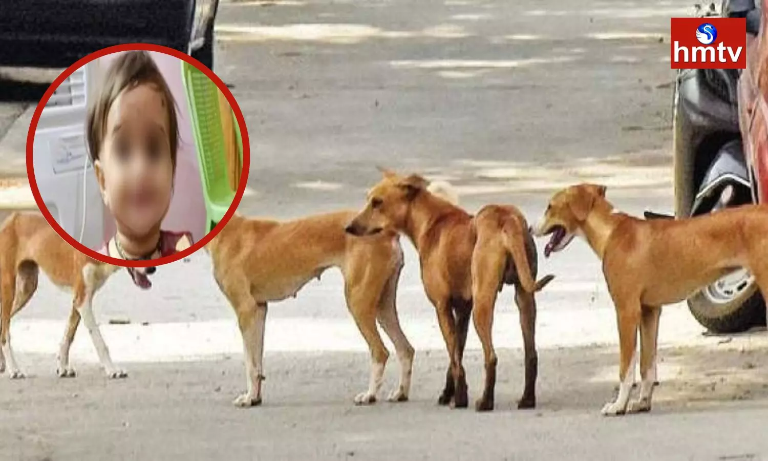 Child Died in an Attack by Stray Dogs in Srikakulam District