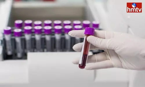 This Golden Blood Group Rare in World Called Rh Null Blood Group