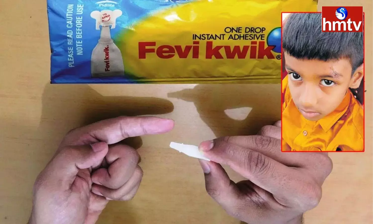 Gadwal Hospital Doctors Show Negligence, Attached Eyes With Fevikwik After Injury