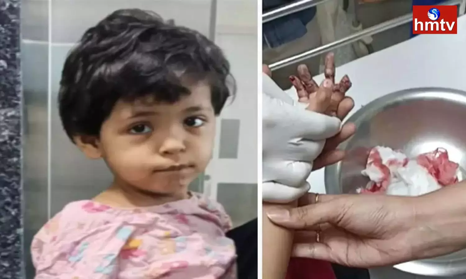 Child Injured In Banjara Hills City Center Mall