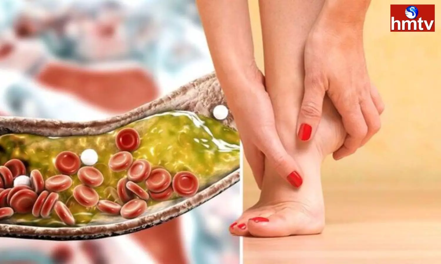 These Problems in the Feet are Bad Cholesterol Symptoms it is Very Dangerous to Ignore