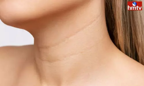 Are you Troubled by Wrinkles on Your Neck if You Follow These Tips it will Return to Normal Are you Troubled by Wrinkles on Your Neck if You Follow These Tips it will Return to Normal