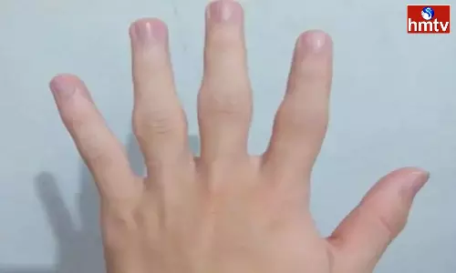 Astrology Finger tips There is no chance of Heart disease for those who have such fingers Along with Intelligence they are full of Luck