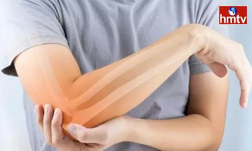 These Bad Habits Cause Weak Bones Stop Immediately