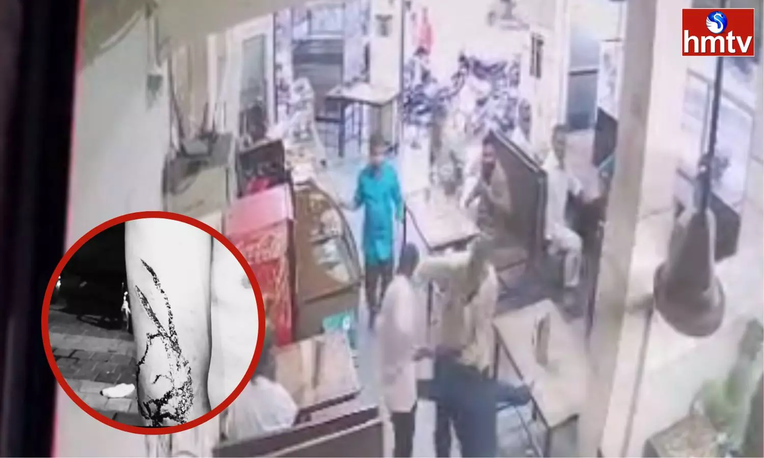 Guy Beaten By Hotel Staff For Asking For Samosa In Balapur Hyderabad