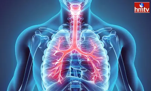 Respiratory diseases are around During rainy season avoid by taking these precautions