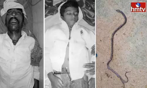 Snake Bites Father And Son In Kamareddy Snake Bites Father And Son In Kamareddy