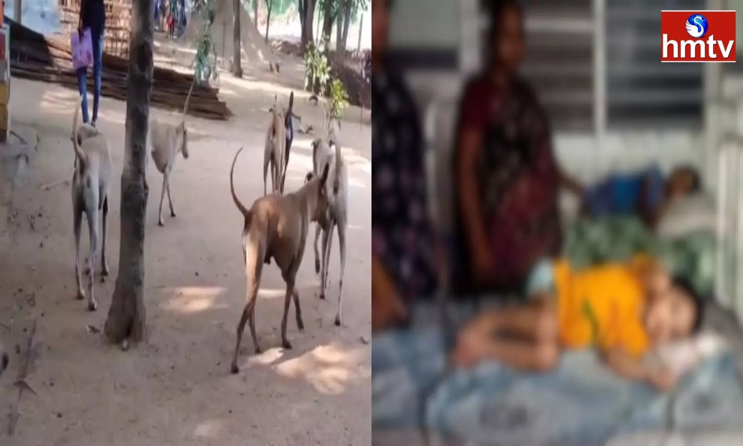 Stray Dogs Attack Children In The Ambedkar Konaseema District