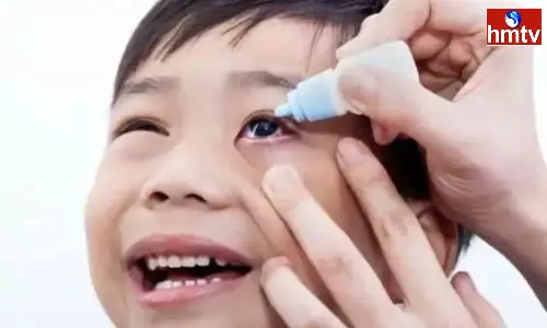 Increasing cases of eye flu Conjunctivitis in Children these Precautions must be followed Increasing cases of eye flu Conjunctivitis in Children these Precautions must be followed