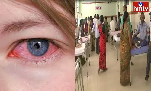 Cases Of Eye Flu Are Increasing In Nizamabad District Cases Of Eye Flu Are Increasing In Nizamabad District
