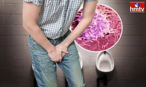 Prostate Cancer Spreading In Men If These Symptoms Appear Consult A Doctor Immediately